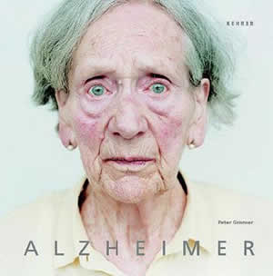 Saúde e Alzheimer