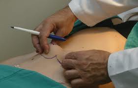 cirurgia plastica