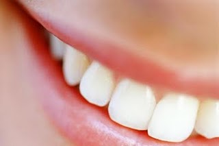Sorriso Branco