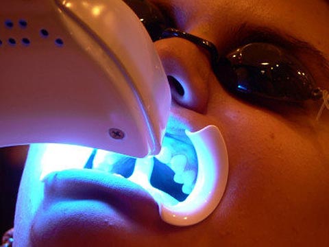 Tratamento a Laser