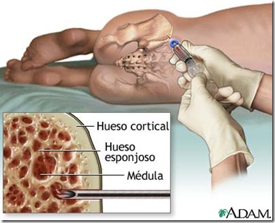 Doenças da Medula