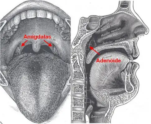 Amigdalite Caseosa, Como Prevenir?