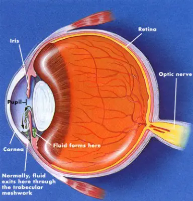 O Que é Glaucoma?